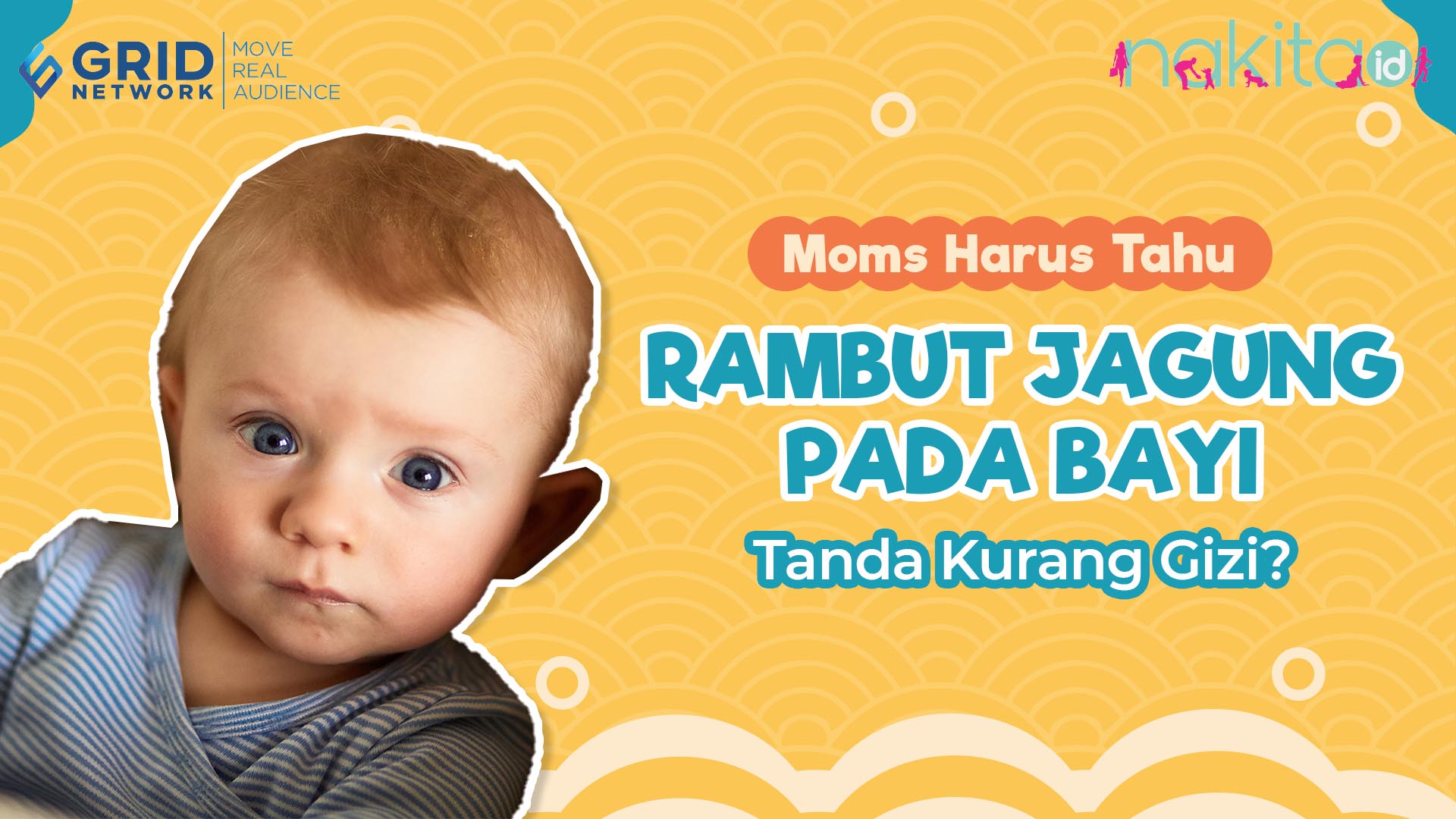 Benarkah Rambut Jagung pada Bayi Tanda Kurang Gizi? 